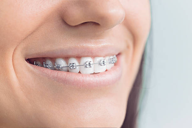 Why Choose Us for Your Dental Needs in Sweeny, TX
